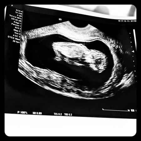 Chris Sullivan's wife, Rachel Sullivan posted a sonogram picture of their baby. Know more about Sullivans' family expectations of welcoming their youngest member.