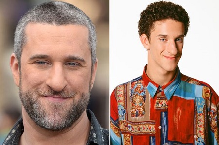 Dustin Diamond Passed Away At 44 From Small Cell Carcinoma