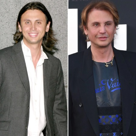 The before and after picture of Jonathan Cheban.